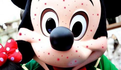 disneyland-measles-665x385