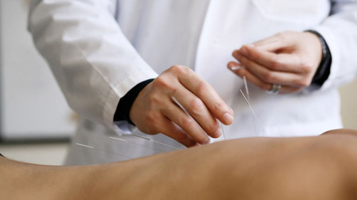 иглотерапия