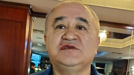 Текебаев после нападения