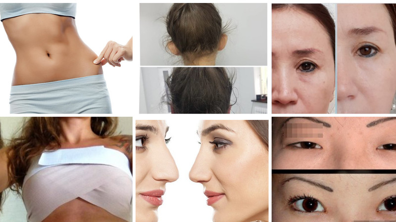 Красота за деньги: Сколько стоят новые лицо и тело, и кто владеет клиниками пластической хирургии в Бишкеке? &mdash; Tazabek