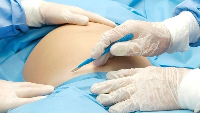 Иллюстративное фото