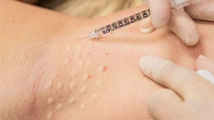 18 people poisoned by botox injections in Osh