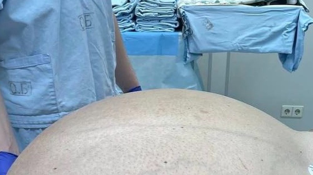 до операции