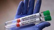 Минздрав: Риск завоза хантавируса в Кыргызстан низкий, угроз для населения нет