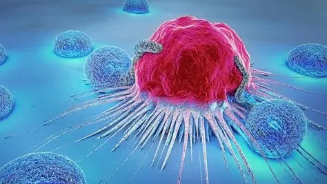 Health Ministry reports rising cancer cases as Kyrgyzstan expands diagnostic equipment nationwide