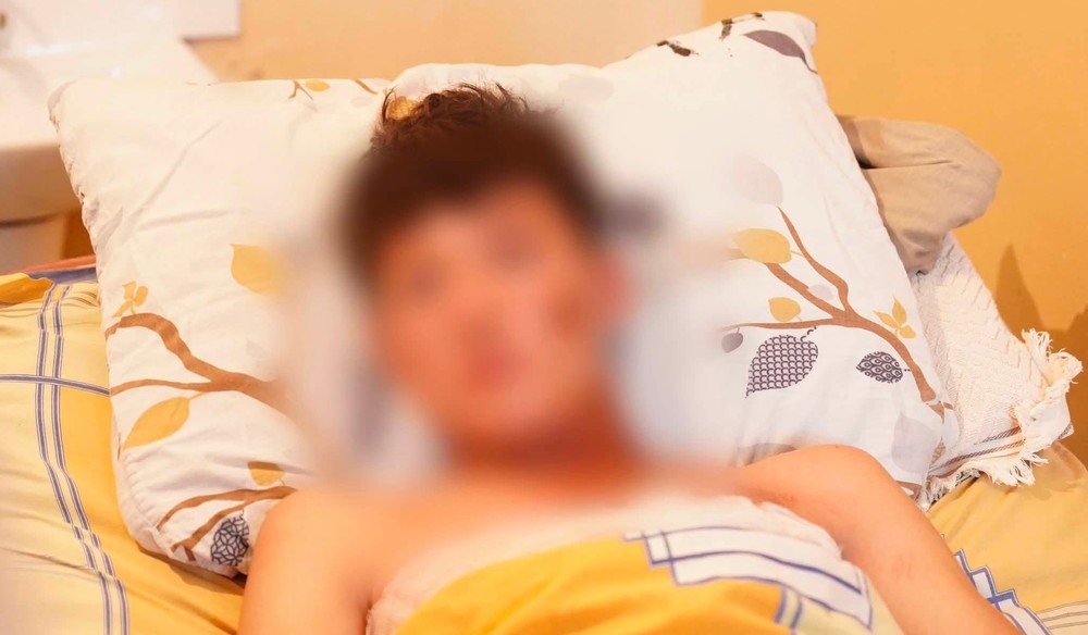 В Майлуу-Суу молния ударила в 16-летнего подростка — его 7 часов везли с пастбища на лошади