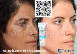 Miracle Glow(Миракле Глоу)-маска от пигментации. Крем-маска.