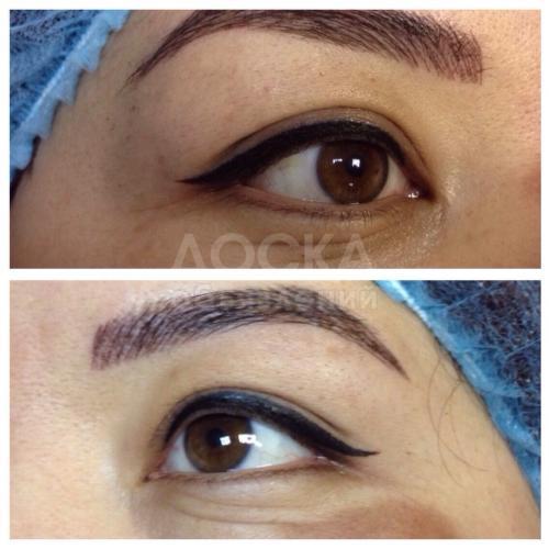 Татуаж бровей, век, губ