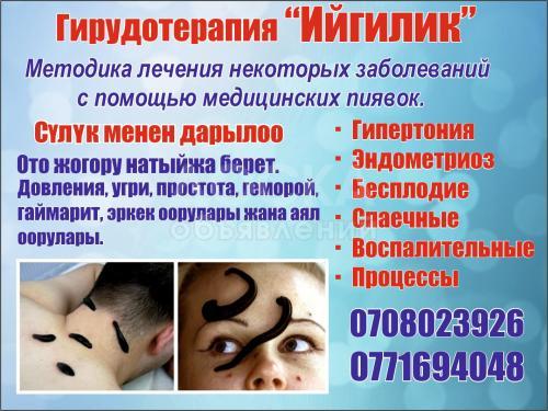 Гирудотерапия «Ийгилик», Лечение пиявками!Надежно.Безопасно