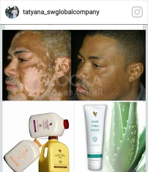 Крем от веснушек и пигментации