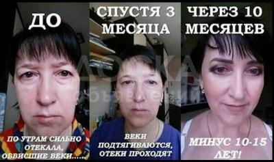Похудение и омоложение без вреда здоровью 100%