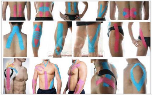 Спортивные тейпы (новинка)