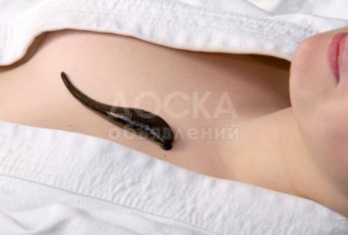 Продаем медицинскую пиявку