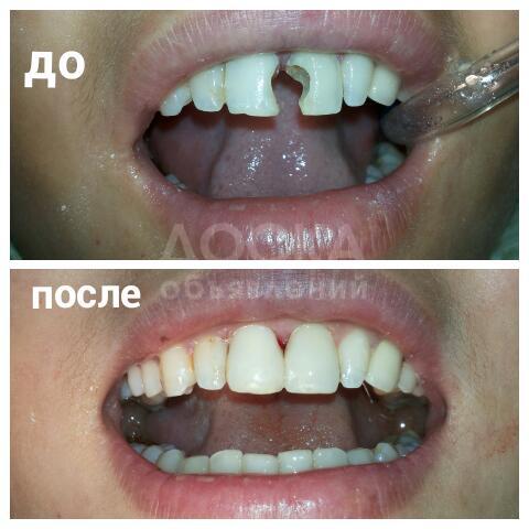 Бесплатное лечение зубов! Акция! Качество! Гарантия! Современные материалы!