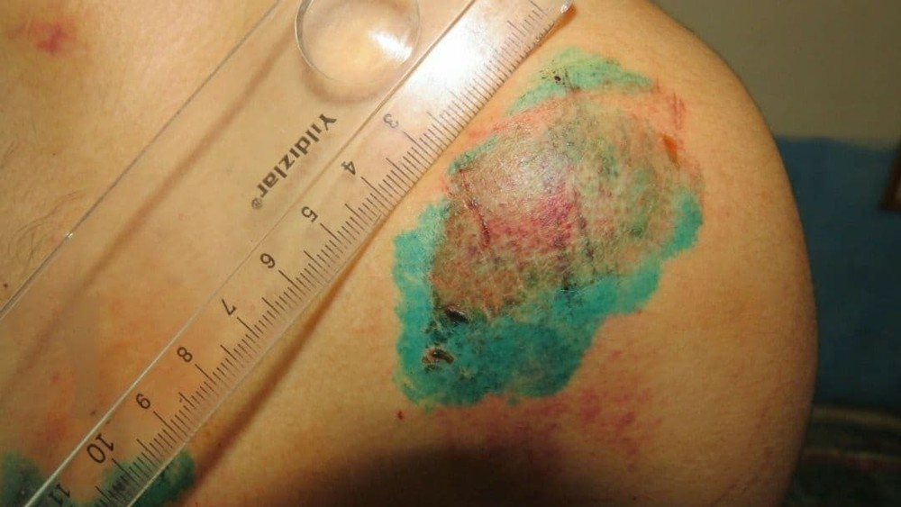 Иллюстрациялык сүрөт