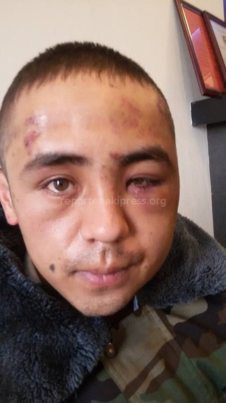 Республиканский комитет солдатских матерей сообщил об избиении солдата офицером, - читатель <b><i>(фото)</i></b>