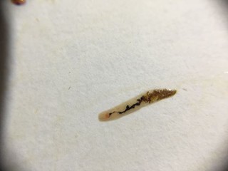 Будьте осторожны при покупке мяса, в жару в них образовываются вредные грибки, - пользователь соцсетей <i>(фото)</i>