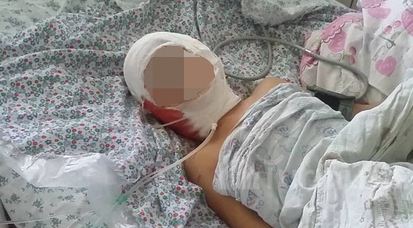 Главное фото