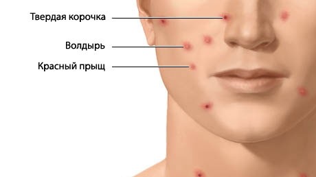 Главное фото