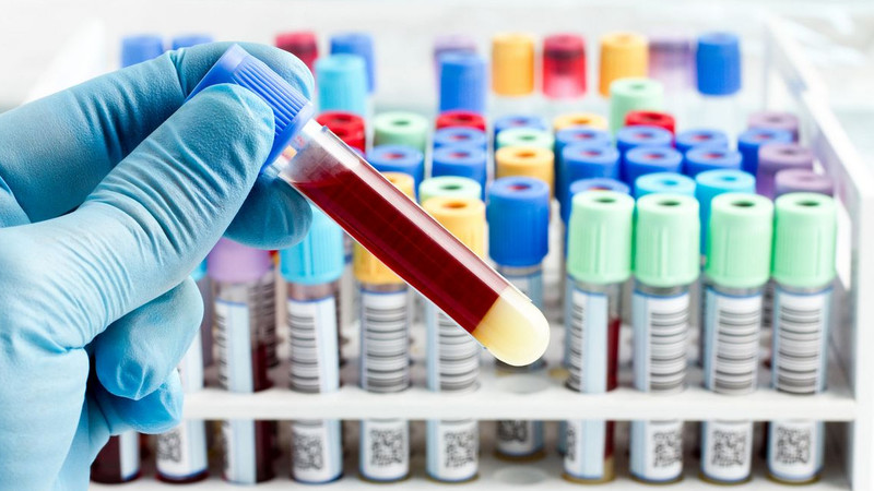 Сколько заплатили в бюджет ЮРФА, лаборатория &laquo;Бонецкого&raquo;, Aqua lab, &laquo;Неомед&raquo; и другие медлаборатории Бишкека? (владельцы) &mdash; Tazabek