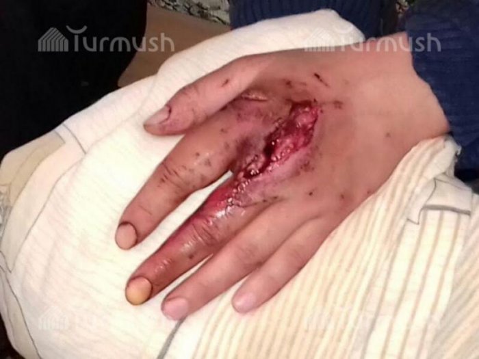 Главное фото