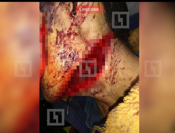 Главное фото