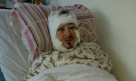 Главное фото