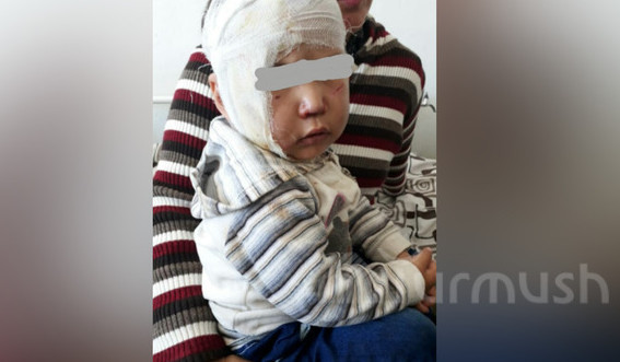 Главное фото