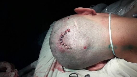 Главное фото