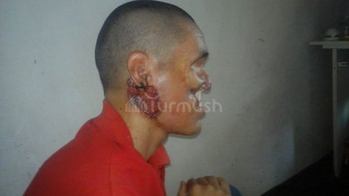 Главное фото