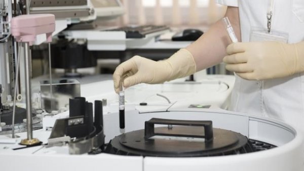 За исключением одной или двух медицинские лаборатории находятся в тени, - замглавы ГНС О.Абдыкаимов &mdash; Tazabek