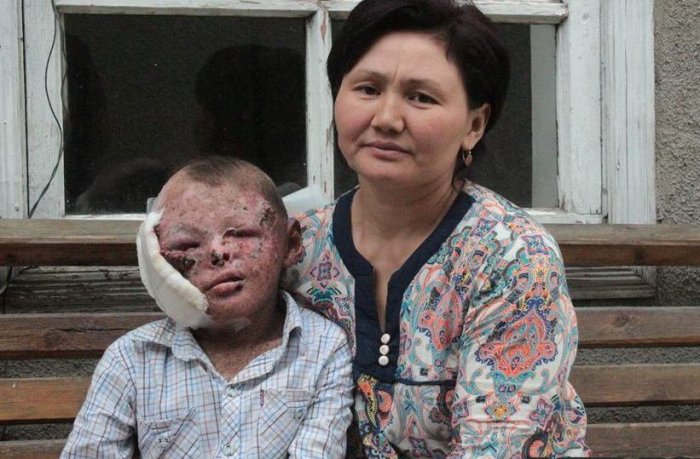 Главное фото