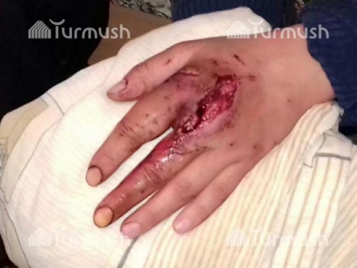 Главное фото