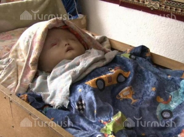 Главное фото