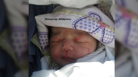 Главное фото