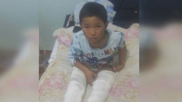 Главное фото