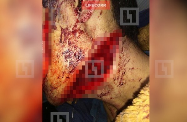 Главное фото